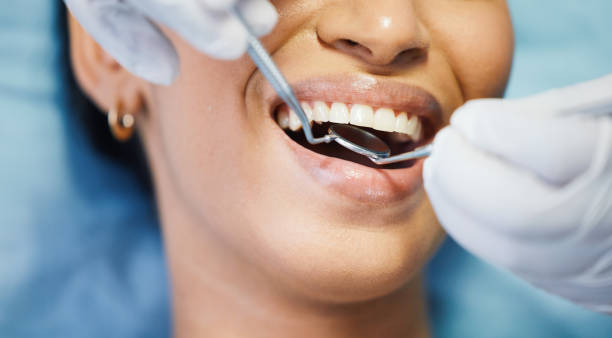 Best Dentist for Severe Toothache  in Coupeville, WA